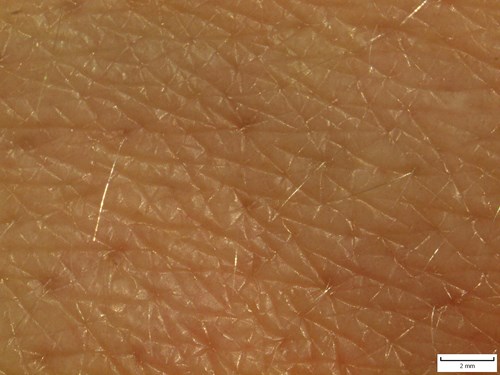 Povrch lidské kůže zvětšený v preparačním mikroskopu. Jsou rozeznatelná lichoběžníková políčka a otvory vlasových folikulů, kde vystupují jednotlivé chloupky na povrch.