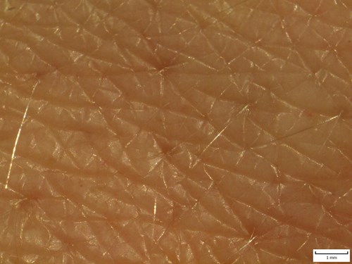 Povrch lidské kůže zvětšený v preparačním mikroskopu. Je vidět detailněji otvory vlasových folikulů nacházející se v prohlubních v pokožce.