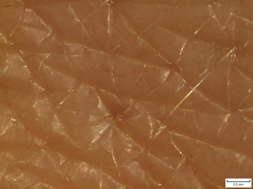 Povrch lidské kůže zvětšený v preparačním mikroskopu. Dobře rozeznatelné ohraničení jednotlivých políček.