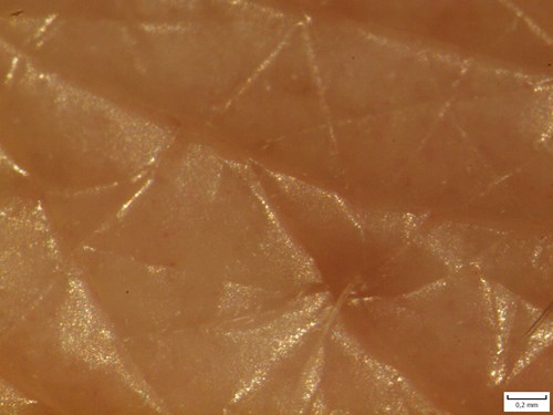 Povrch lidské kůže zvětšený v preparačním mikroskopu. Detail výstupu chlupu z vlasového folikulu. Pod pokožkou prosvítají cévy (červené tečky). 