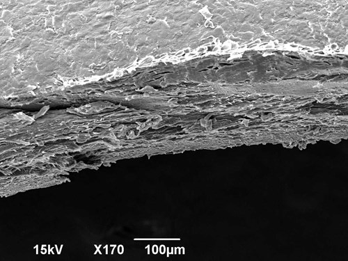 Ustřižený konec nehtu v elektronovém mikroskopu. Viditelné jsou vrstvy keratinu. Zvětšeno 170x.