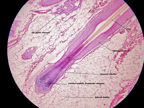 Řez kůží ve světelném mikroskopu. Je vidět vlasový folikul, jeho papila, vlasová pochva s vlasem. Okolo jsou tukové buňky a také potní žláza. Zvětšeno 100x.