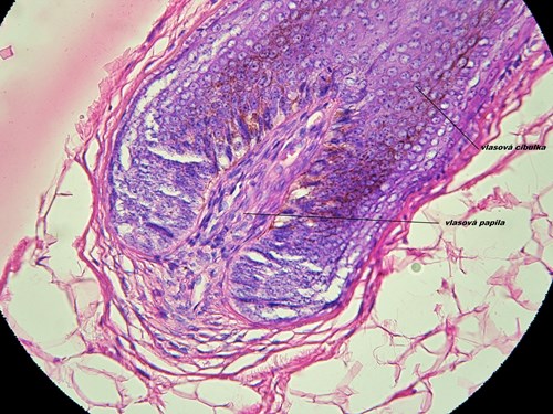 Řez kůží ve světelném mikroskopu. Je vidět vlasový folikul a jeho papila. Okolo jsou tukové buňky. Zvětšeno 200x.