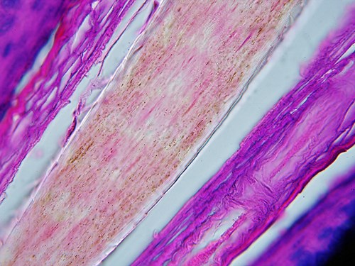 Řez kůží ve světelném mikroskopu. Je vidět  vlasová pochva s vlasem. Na jeho povrchu je vidět šupinatá kutikula a pod ní kůra vlasu. Zvětšeno 1000x