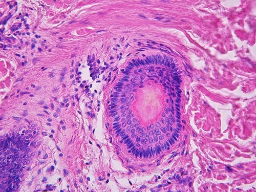  Příčný řez vlasovým folikulem. Uprostřed je vlas, okolo něj folikulární buňky. Zvětšeno ve světelném mikroskopu 400x.