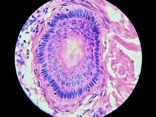 Příčný řez vlasovým folikulem. Uprostřed je vlas, okolo něj folikulární buňky. Zvětšeno ve světelném mikroskopu 1000x.