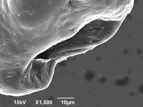 Vyklenutí pro vlasovou bradavku ve vlasové cibulce. Zvětšeno v elektronovém mikroskopu 1500x.