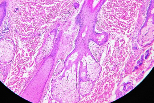 Řez kůží ve světelném mikroskopu. Jsou vidět vlasové folikuly a s napojenými mazovými žlázami. Zvětšeno 100x.