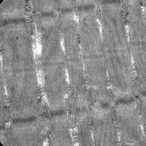 Příčně pruhovaný sval pod transmisním elektronovým mikroskopem (TEM) zvětšený 36000x. Jasně viditelné Z linie, I proužky, A proužky, a také lze rozeznat jednotlivé myofibrily. Mezi svazky vláken jsou viditelné mitochondrie.