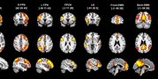 Inter-individual differences in baseline dynamic functional connectivity are linked to cognitive aftereffects of tDCS
