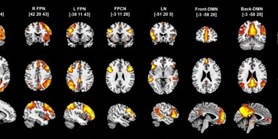 Inter-individual differences in baseline dynamic functional connectivity are linked to cognitive aftereffects of tDCS