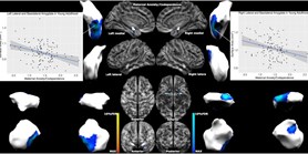 Perinatal maternal mental health and amygdala morphology in young adulthood