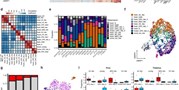 The landscape of tumor cell states and spatial organization in H3-K27M mutant diffuse midline glioma across age and location
