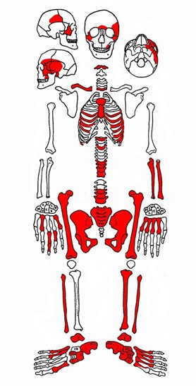 Soběšice – grafické schéma zachovalosti 77 let nepohřbeného skeletu (zachované části červeně)