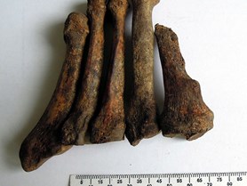 Soběšice – záprstní kosti levého chodidla s patrnou destrukcí prvního metatarsu (ztráta palce)