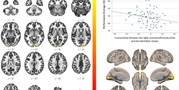 Parental education, cognition and functional connectivity of the salience network