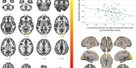 Parental education, cognition and functional connectivity of the salience network