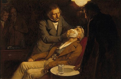 W. Morton provádí anestezii éterem.