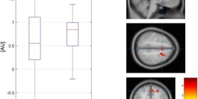 Language impairment in Parkinson's&#160;disease: fMRI study of sentence reading comprehension