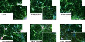 Effects of all-trans and 9-cis retinoic acid on differentiating human neural stem cells in vitro