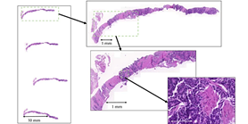 New Paper in Nature Communications: Privacy Risks of Whole-Slide Image Sharing in Digital Pathology