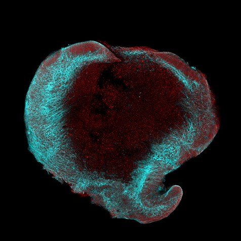 Mikroskopický snímek cerebrálního organoidu D97 derivovaného z indukovaných pluripotentních kmenových buněk. Maturované neurony jsou značeny pomocí NeuN (zelenomodrá) a buněčná jádra pomocí Hoechstova barviva (červená). Foto: V. Pospíšilová.
