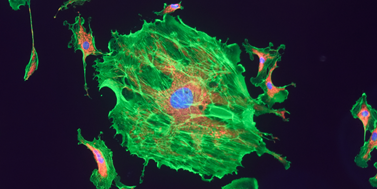 WNT signalling in mammary fibroblasts