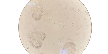 Zavedení technologie embryoidů/gastruloidů pro studium signalizace primárních cilií