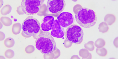 Continuous xenotransplantation model of acute myeloid leukemia