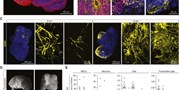 Cerebral organoids derived from patients with Alzheimer's&#160;disease with PSEN1/2 mutations have defective tissue patterning and altered development