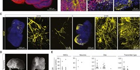 Cerebral organoids derived from patients with Alzheimer's&#160;disease with PSEN1/2 mutations have defective tissue patterning and altered development