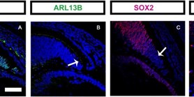 Role of ciliopathy protein TMEM107 in eye development: insights from a&#160;mouse model and retinal organoid