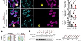 Mitochondriální ribozomy jako cíl léčby pro agresivní formy dětských neuroblastomů? 