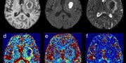 Possibilities of Using Multi-b-value Diffusion Magnetic Resonance Imaging for Classification of Brain Lesions