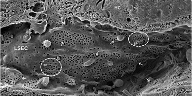 Podíl antipsychotik na stárnutí jater a úbytku nanopórů (fenestrací) na jaterních sinusoidálních endoteliálních buňkách (LSEC)