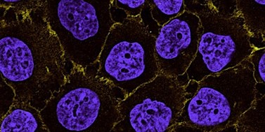 4TARGET: Novel eIF4F inhibitors for the treatment of drug-resistant melanoma