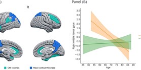 Sex differences in brain atrophy in dementia with Lewy bodies
