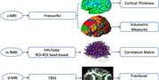 Neuroimaging-based classification of PTSD using data-driven computational approaches: A&#160;multisite big data study from the ENIGMA-PGC PTSD consortium