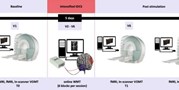 Exploring the impact of intensified multiple session tDCS over the left DLPFC on brain function in MCI: a&#160;randomized control trial