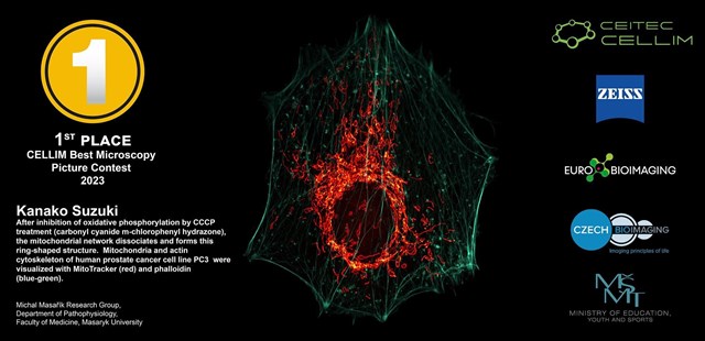 The winning image by Kanako Suzuki in the CELLIM Best Microscopy Picture Contest 2023.