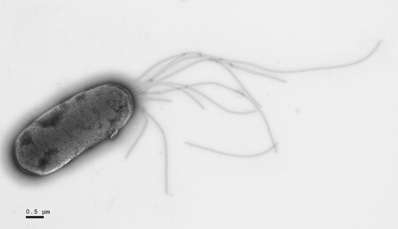 Obrázek 1. Bakterie Pseudomonas putida, jejíž adaptaci na cukr xylózu studoval tým vědců z Masarykovy univerzity. Foto: Archiv CNB-CSIC, Madrid