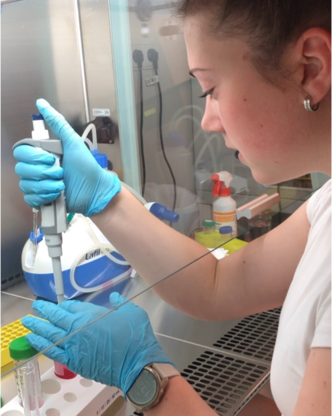 Enzymy, peptidy a fluorescenční mikroskop: Jak mladá vědkyně pomáhá měnit pohled na Alzheimera