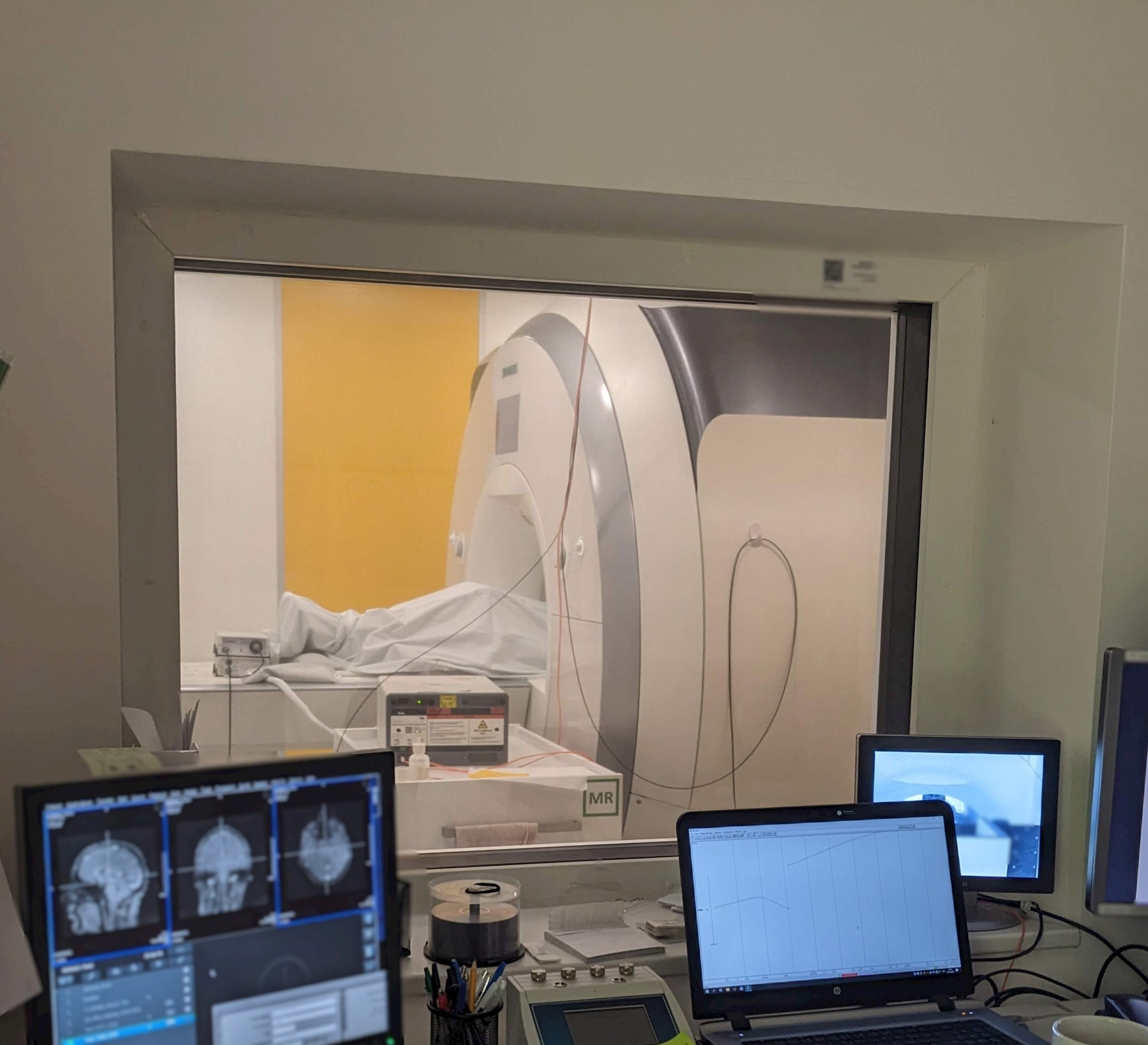 Measuring brain activity using functional magnetic resonance imaging.
