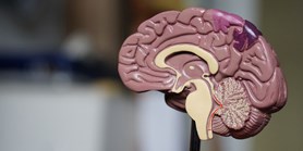 Na zlepšení léčby cévních mozkových příhod se zaměří brněnští výzkumníci
